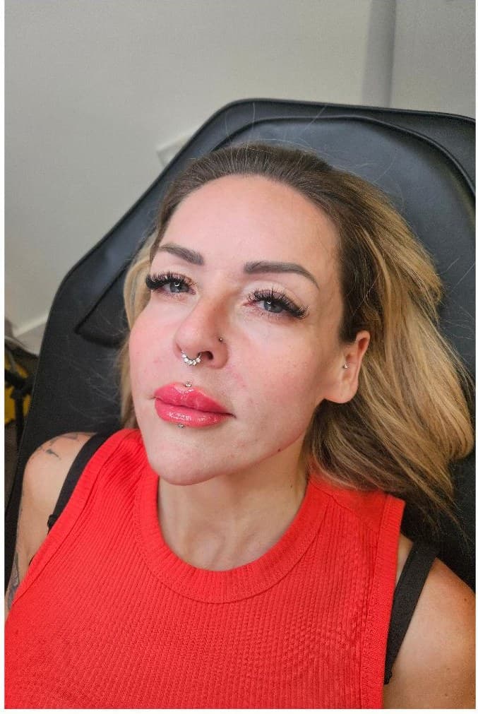 A client's lips following a dermal filler treatment at the Dereham clinic.